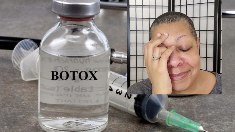 I Got Botox… and I Felt Like Pinhead in Hellraiser?! | Botox for Migraine Treatment & Prevention