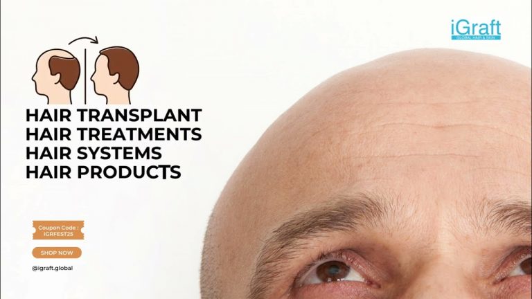 FESTival are here with 25% discount for Limited time on iGraft Hair Transplant Treatments & Services