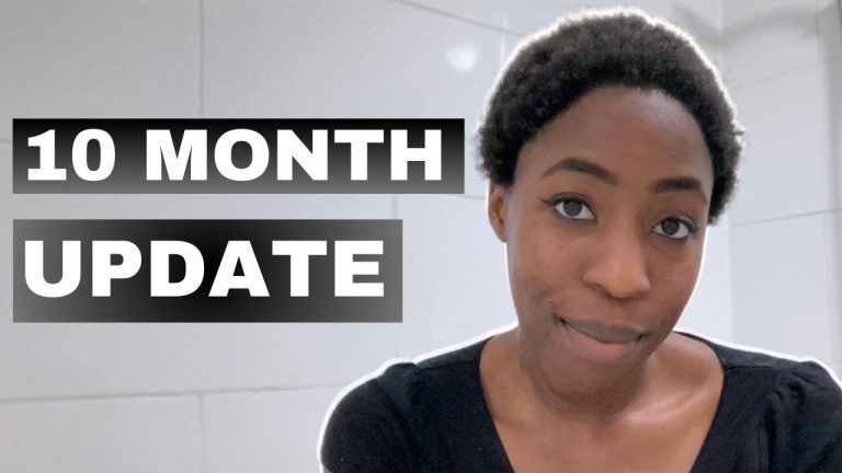 10 Months Post Hair Transplant Update | Heva Clinic Turkey